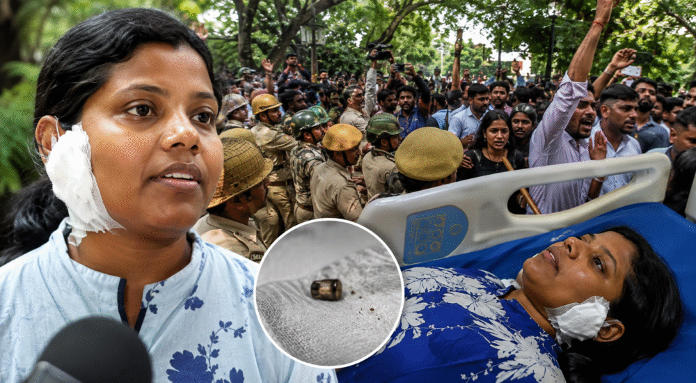 जंतर-मंतर प्रदर्शन में घायल छात्रा नूतन टोप्पो अस्पताल में इलाज के दौरान।